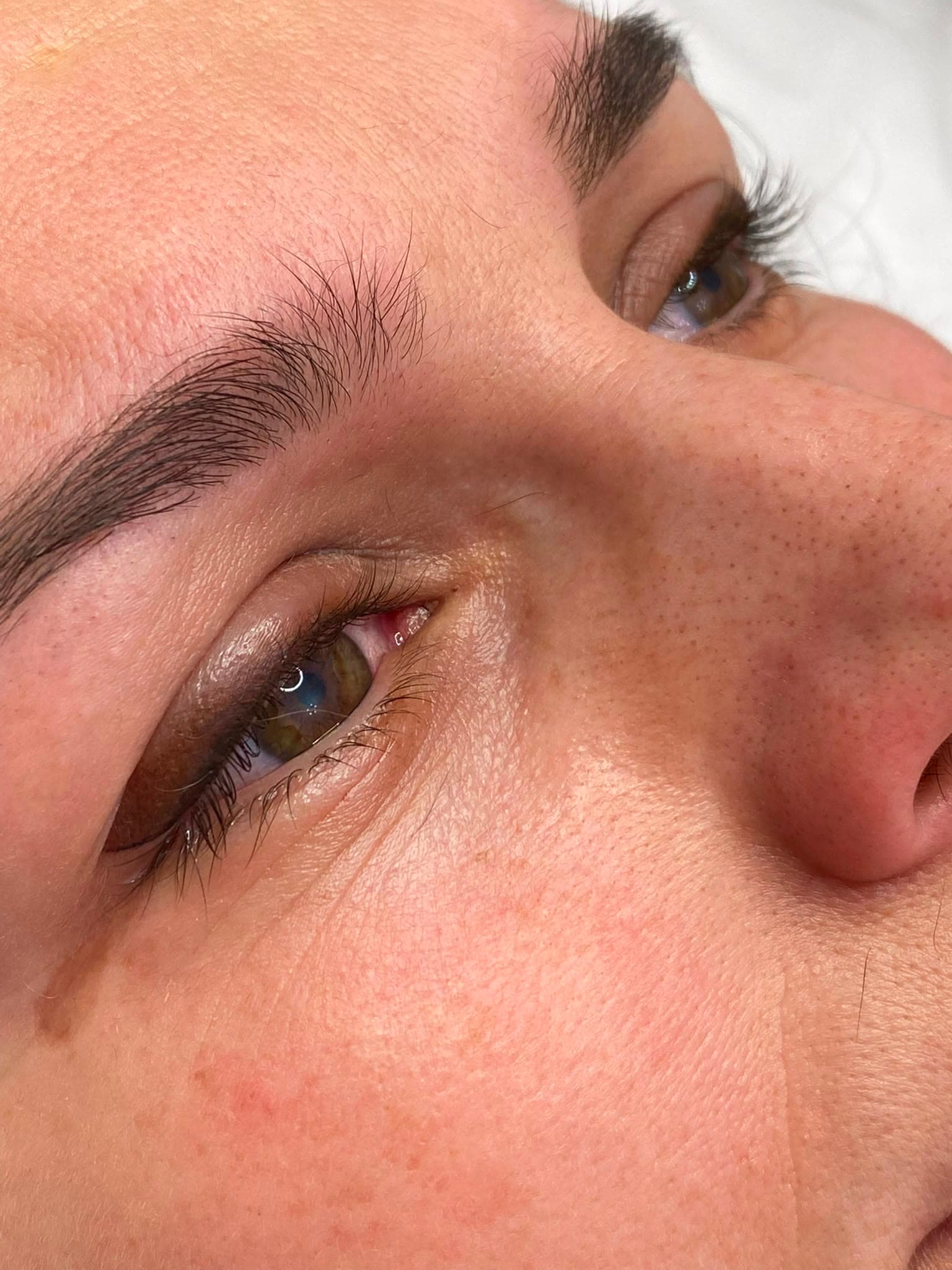 Augen PMU